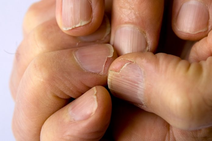 Salud que se refleja en las uñas