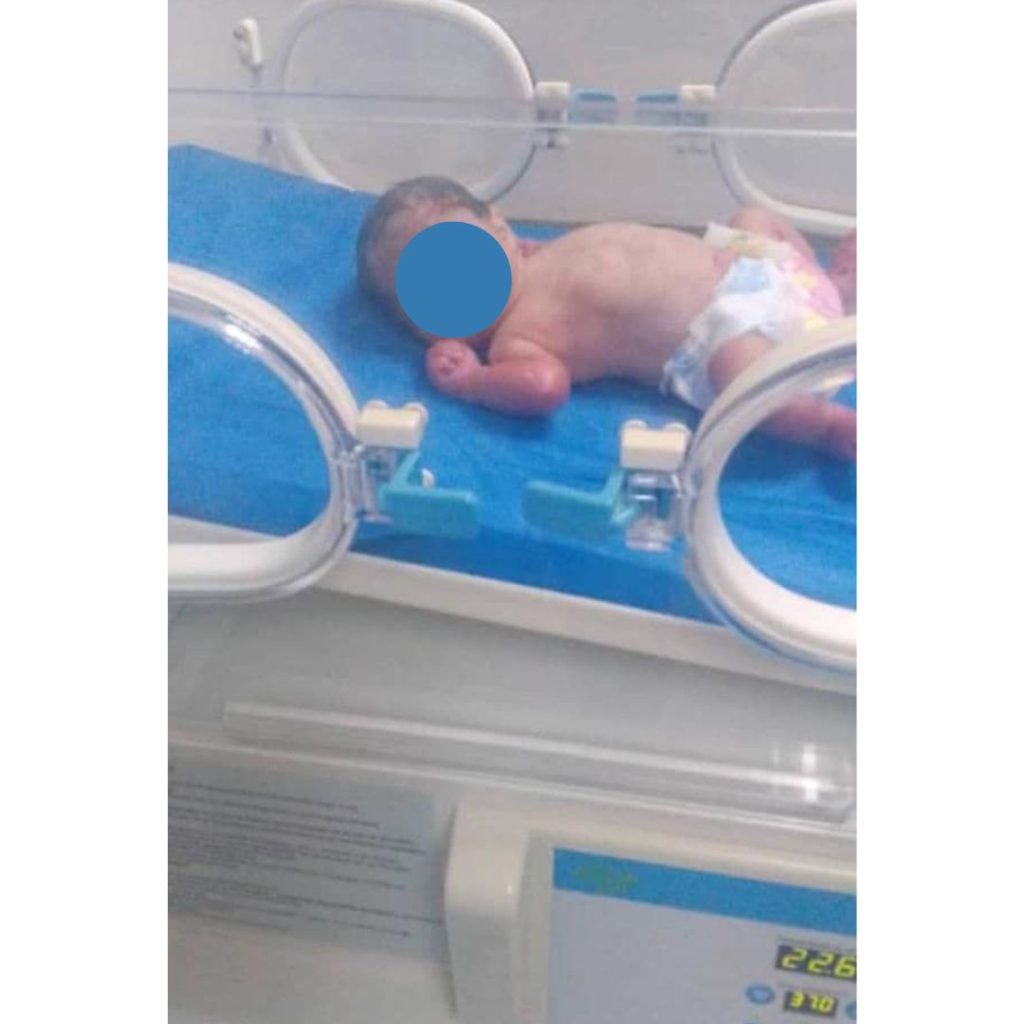 Bebé de 32 semanas de nacida fue hallada en basurero