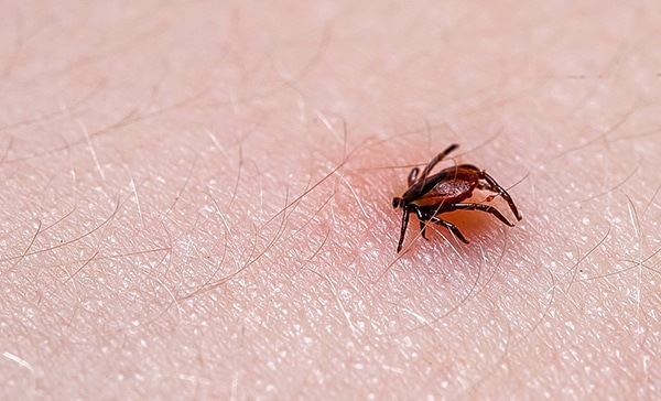 Advertencia Epidemiológica: Casos del virus de garrapatas en Táchira durante 2024