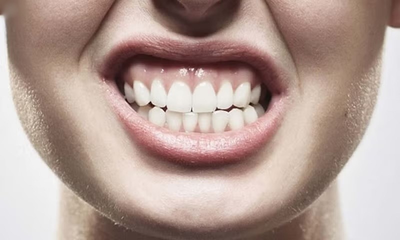 ¿Qué es el bruxismo y cómo afecta a la salud?