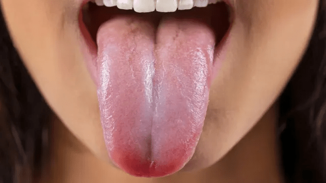 La lengua como indicador de salud