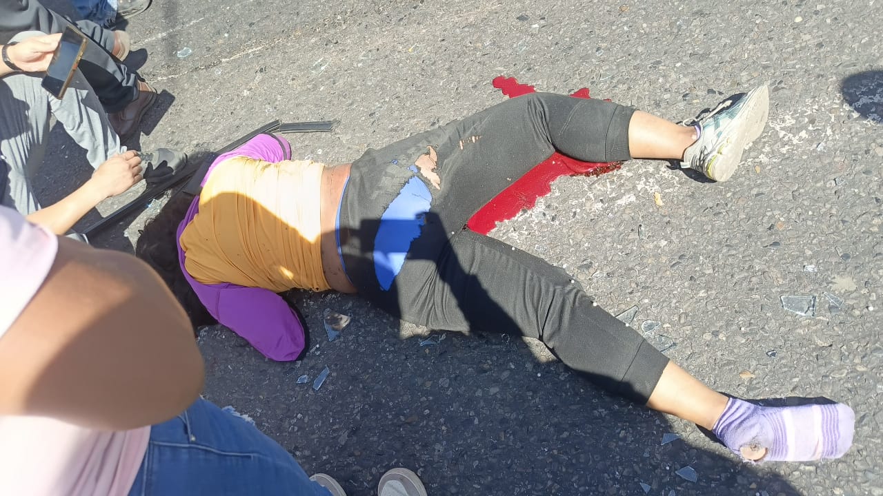 ¡Tragedia en Barquisimeto! Falla mecánica de una buseta, expulsó a pasajera por el parabrisas